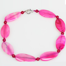 Horse Eye Shape Rose Pink Agate Choker Necklace Jewelry